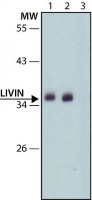 Anti-Livin (C-terminal) antibody produced in rabbit 