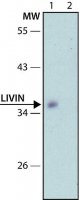 Anti-Livin (N-terminal) antibody produced in rabbit 