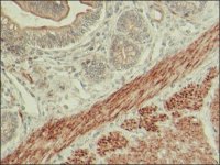 Anti-LMOD1 antibody produced in rabbit 