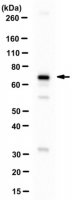 Anti-Mediator complex subunit 25 