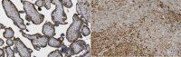 Anti-MMP-11 (Stromelysin-3) Antibody, clone 5ST-4A9 MABC1607-25UG