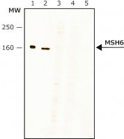 Anti-MSH6 (N-terminal) antibody produced in rabbit 
