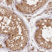 Anti-MYBL2 antibody produced in rabbit 
