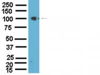 Anti-Na+/K+ ATPase -1 Antibody 