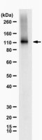 Anti-Na+/K+ ATPase alpha-3 