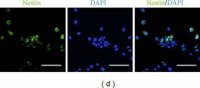 Anti-Nestin Antibody, clone 10C2 