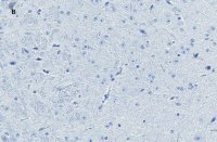 Anti-NeuN Antibody, clone 13E6, ZooMAb Rabbit Monoclonal 