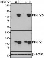 Anti-Neuropilin-2b 