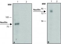 Anti-Nexilin antibody,Mouse monoclonal 
