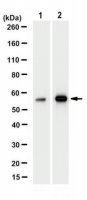 Anti-Nicotinic Acetylchone Receptor alpha 1 Antibody, clone 7C8.2 