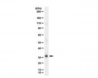 Anti-NRL (Neural Retina Leucine Zipper) 