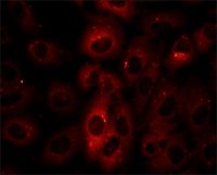 Anti-p62/SQSTM1 antibody produced in rabbit 