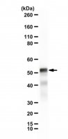 Anti-PAXIP1 