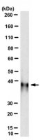 Anti-PCBP2 (hnRNP E2) Antibody, clone PC81-1 