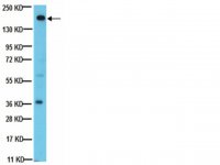 Anti-PDGFR Antibody, clone CH-3 