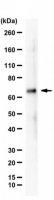 Anti-PHF1 