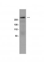Anti-phospho-Acetyl CoA Carboxylase (Ser79) Antibody 
