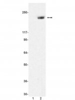 Anti-phospho-erbB-2/HER-2 (Tyr1248) Antibody 