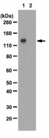 Anti-phospho-FGFR-1 (Tyr653/Tyr654) Antibody 