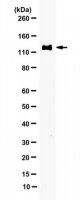 Anti-phospho-MDA-5 (Ser104) 