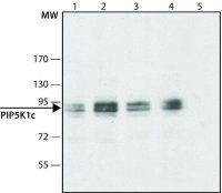 Anti-PIP5K1C (C-terminal) antibody produced in rabbit 