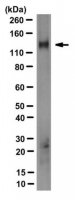 Anti-PMCA4b Antibody, clone JA3 