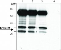Anti-PPM1M (C-terminal) antibody produced in rabbit 