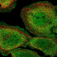 Anti-PPP1CA antibody produced in rabbit 