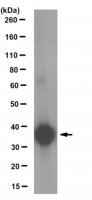 Anti-R-Spondin 2 Antibody, clone 14C7.1 