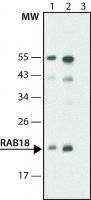 Anti-Rab18 (C-terminal) antibody produced in rabbit 