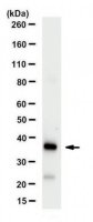 Anti-RANKL Antibody, clone 6A12.1 