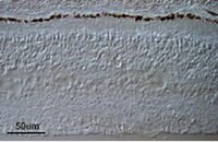 Anti-Retinal Pigment Epithelium 65 Antibody 