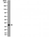 Anti-RPA2 p34 Antibody, clone RPA20 1-46 