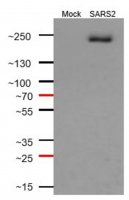 Anti-SARS-CoV-1/2 S Protein Antibody, clone 2B3E5 ZooMAb Mouse Monoclonal 