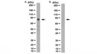 Anti-sodium/hydrogen exchanger 3 Antibody, clone 3H3 