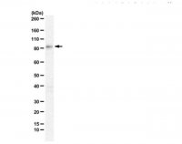 Anti-STRN3 