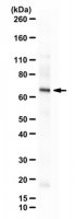 Anti-TBR-2 