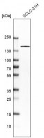 Anti-TP53BP1 antibody produced in rabbit 