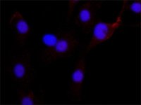 Anti-Twist1 antibody produced in rabbit 