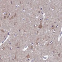 Anti-UBE2O antibody produced in rabbit 