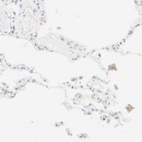 Anti-UPK3B antibody produced in rabbit 
