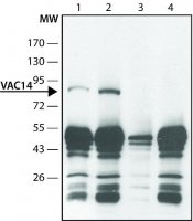 Anti-VAC14 (C-terminal) antibody produced in rabbit 