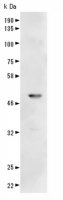 Anti-Vaccinia related kinase-1 Antibody, C-Terminus 