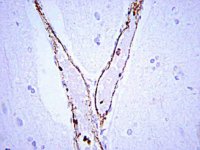 Anti-von Willebrand Factor Antibody 