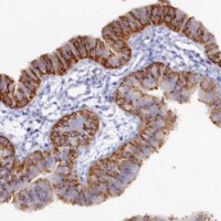 Anti-WDR35 antibody produced in rabbit 