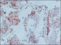Monoclonal Anti-MeCP2 antibody produced in mouse 