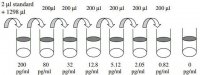 Human EGF ELISA Kit RAB0149-1KT