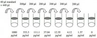Human IL-6 ELISA Kit RAB0306-1KT
