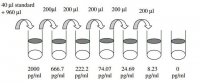 Human MSP ELISA Kit RAB0475-1KT